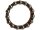 FULCRUM Kugelring OS, Satz &agra